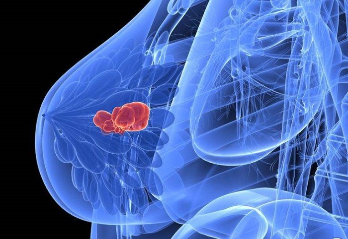 Kontrastlı Mamografi Nedir? Kontrastlı Mamografi Nedir?