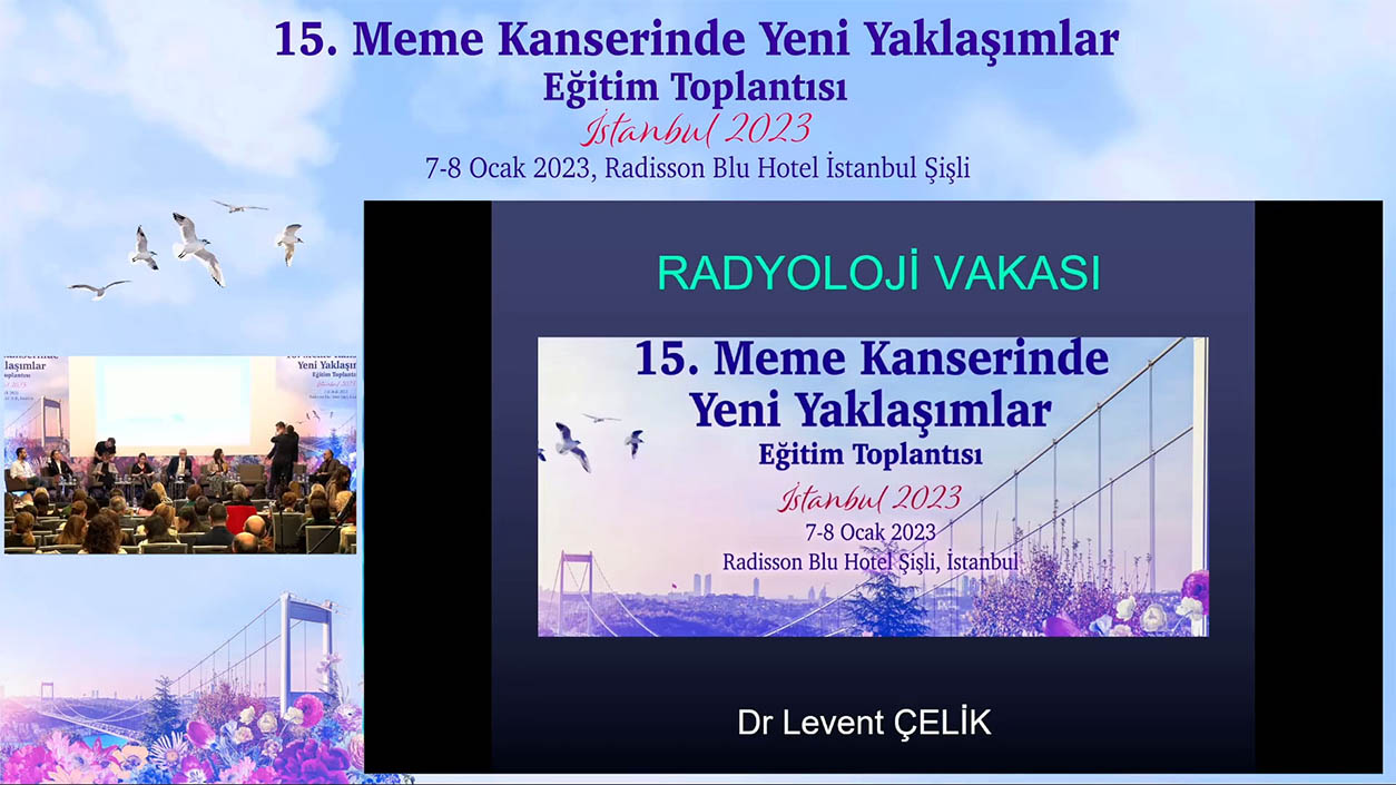 15. Meme Kanseri Yeni Yaklaşımlar 2023