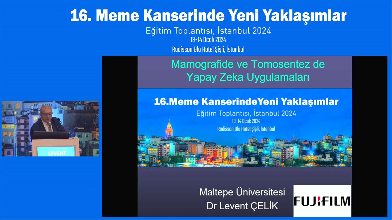 16. Meme Kanseri Yeni Yaklaşımlar Mamografide ve Tomosentezde Yapay Zeka Uygulamaları