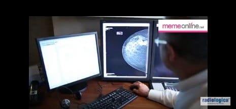 Kimler Mamografi Yaptırmamalıdır?
