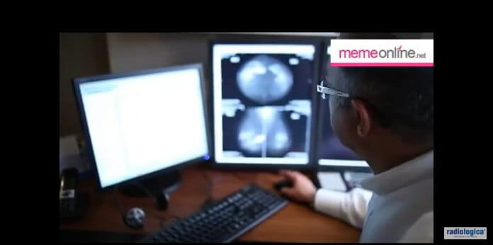 Mamografi çekimi içi herhangi bir hazırlık gerekli midir?