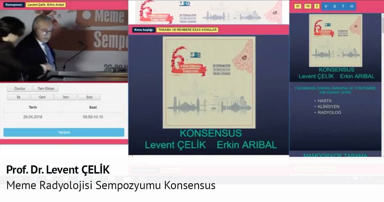 Meme Radyolojisi Sempozyumu Konsensus