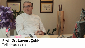 Telle İşaretleme 